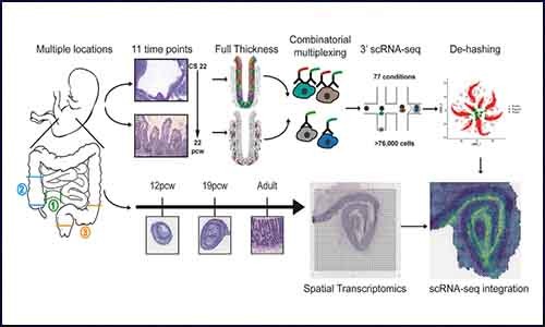 強強聯(lián)手 | 單細胞測序 & 空間轉錄組測序揭示腸道發(fā)育