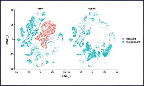 生信分析 | 個性化分析之惡性腫瘤分析