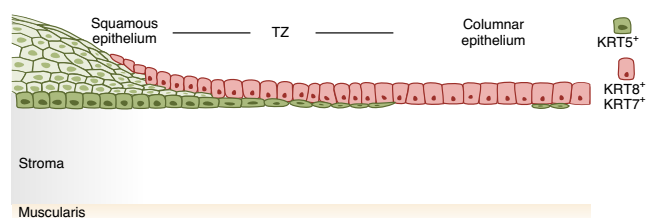 宮頸的鱗狀和柱狀譜系以及過渡區(qū)的示意圖