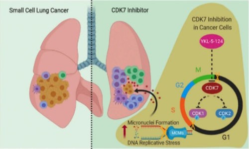 抑制 CDK7 表達破壞基因組復制進程，觸發(fā)抗腫瘤免疫反應(yīng)