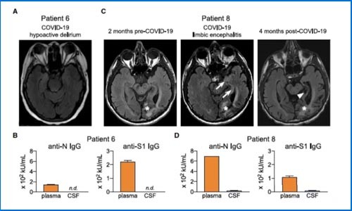 干貨解讀 |Olink 助力癌癥患者感染 COVID-19 后引發(fā)神經(jīng)障礙機(jī)制研究