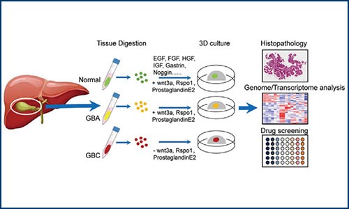 項目文章 | 伯豪生物單細(xì)胞測序分析助力類器官膽囊癌建模和藥物篩選
