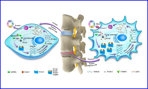 文獻(xiàn)解讀 |WTAP 介導(dǎo)的 lncRNA NORAD 的 m6A 修飾促進(jìn)椎間盤退變（IVDD）