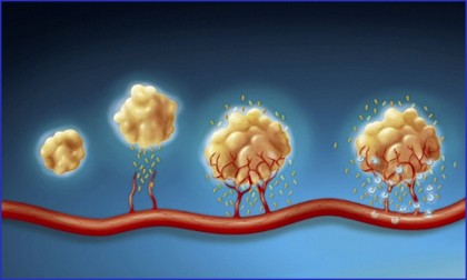 文章解析 |Cell 首次大規(guī)模高分辨率揭示從一個(gè)攜帶致癌突變的單細(xì)胞演變?yōu)榍忠u性腫瘤的全過程