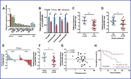 項(xiàng)目文章 | 伯豪生物 circRNA 測序助力在肢端和皮膚黑色素瘤的轉(zhuǎn)移中發(fā)揮重要作用的調(diào)控因子 --circZNF609
