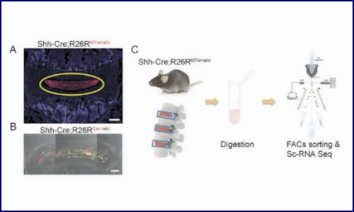 文獻(xiàn)解讀 | 鑒定和應(yīng)用髓核前體細(xì)胞治療椎間盤(pán)退變