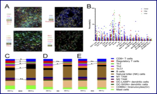 文獻解讀 | 膽管癌的免疫細胞圖譜揭示不同的腫瘤微環(huán)境和相關(guān)預(yù)后的關(guān)系
