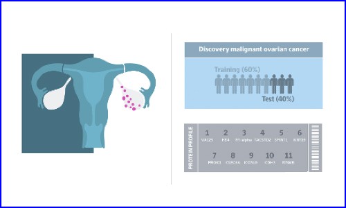 文獻解讀 | 運用 Olink 蛋白質(zhì)組發(fā)現(xiàn)生物標志物組合加速卵巢癌無創(chuàng)早診
