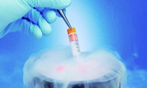 單細(xì)胞全長(zhǎng)轉(zhuǎn)錄本測(cè)序 | 樣品的選擇與實(shí)驗(yàn)細(xì)節(jié)