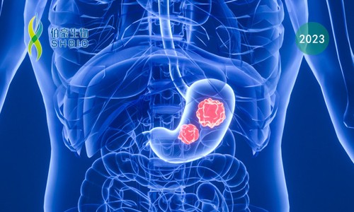 文獻(xiàn)解讀 | 胃癌患者免疫細(xì)胞的單細(xì)胞轉(zhuǎn)錄組測(cè)序