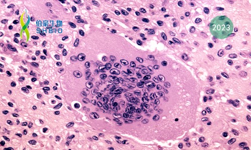 文獻(xiàn)解讀 | 單細(xì)胞分辨率下破骨細(xì)胞形成過程