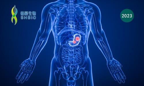 Cell 子刊 | 基于單細(xì)胞轉(zhuǎn)錄組測(cè)序數(shù)據(jù)，揭示胃腺癌進(jìn)展過程中免疫、基質(zhì)細(xì)胞狀態(tài)及生態(tài)型演變