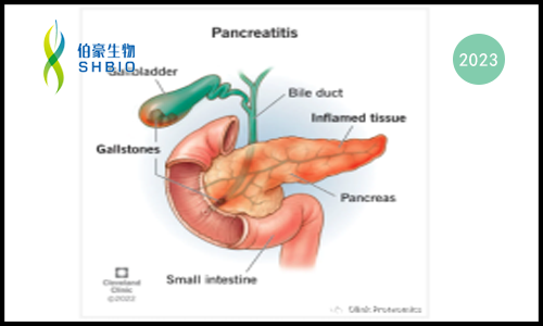 新文速遞 |Olink 蛋白組學助力貝勒醫(yī)學院大型前瞻性胰腺炎血清免疫譜新發(fā)現(xiàn)