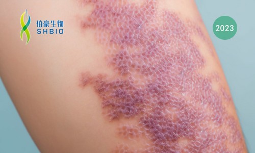 多組學聯(lián)合文章速遞 | 空間轉(zhuǎn)錄組 + 單細胞 + 蛋白組學共同揭示特應性皮炎中復雜的炎癥細胞網(wǎng)絡