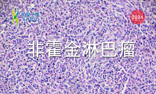 文獻(xiàn)解讀 | PD- 1 在 T 細(xì)胞淋巴瘤中相關(guān)抑制代謝程序，限制糖酵解和抑制 AP- 1 活性