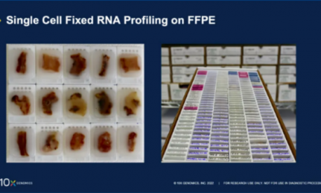 技術(shù)突破 | FFPE 樣本產(chǎn)出高質(zhì)量單細(xì)胞數(shù)據(jù)的秘籍